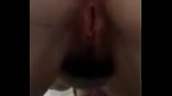 Zoomed in on Stephanies gash